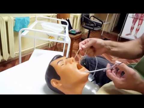 Видео: Задняя тампонада носа