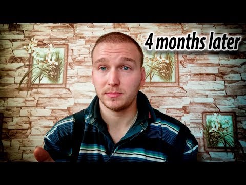 Видео: Пересадка волос обзор 4 месяца