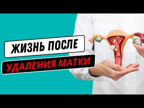 Видео: Удаление матки? Врач объяснил ВСЕ ньюансы