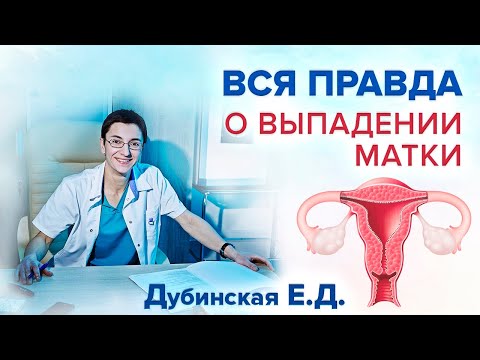 Видео: Что делать при опущении матки? Как не допустить выпадения влагалища? Заблуждения и реальность