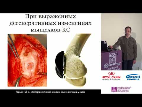 Видео: Карелин М. С. - Хирургическое лечение при ВКЧ