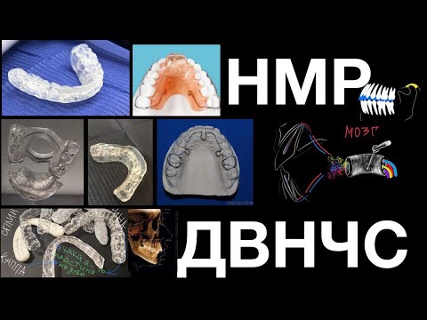 Видео: Принципы действия капп, депрограммация и репозиция - ДВНЧС - ВНЧС - НМР
