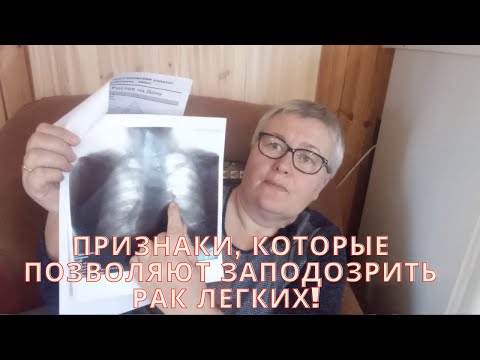 Видео: Признаки, которые позволяют заподозрить рак легких! Предрасполагающие факторы.