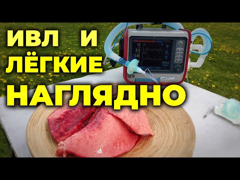Видео: Что происходит с лёгкими при разных режимах ИВЛ #ПроСМП