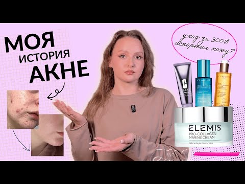 Видео: АКНЕ после 25: моя история и ОШИБКИ в уходе за жирной кожей с акне