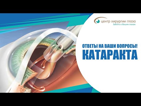 Видео: Катаракта - ответы на ваши вопросы!