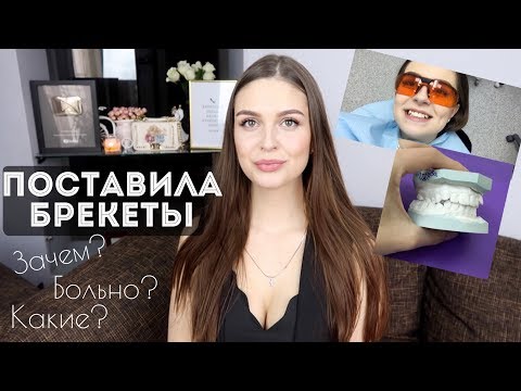 Видео: Я СТАВЛЮ БРЕКЕТЫ! БОЛЬНО? Мои первые впечатления 😬