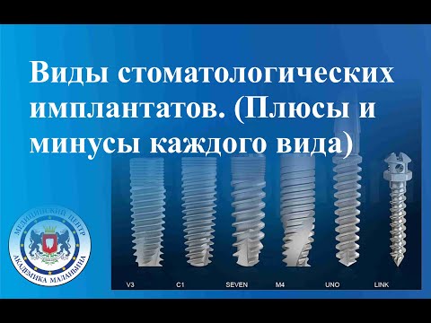 Видео: Виды стоматологических имплантатов.  Плюсы и минусы каждого вида