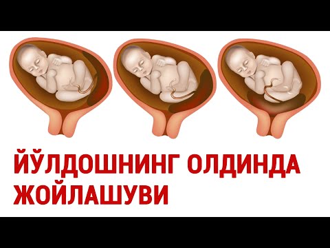 Видео: Йўлдошнинг олдинда келиши #doctorYakubjonov