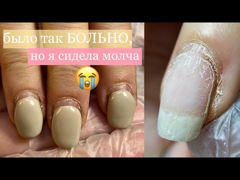 Видео: Было так БОЛЬНО, но я сидела МОЛЧА 🤐😵