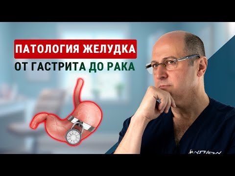 Видео: Патология желудка: от гастрита до рака — диагностика и профилактика | доктор Юрий Гольдес