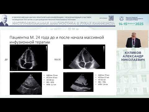 Видео: Полезна ли эхокардиография для исследования центральной гемодинамики?