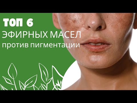Видео: Убери пигментацию на лице. Эфирные масла. Убрать пигментацию без боли