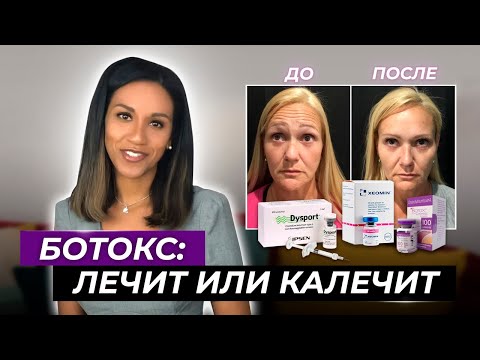 Видео: BOTOX //Как убрать морщины лба, морщины межбровья и "гусиные лапки" // Ботокс от морщин: за и против