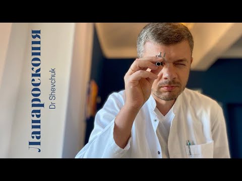 Видео: Лапароскопія/ Laparoscopy