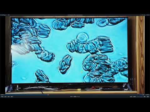 Видео: Исследование крови под темнопольным микроскопом (13.07.2022)