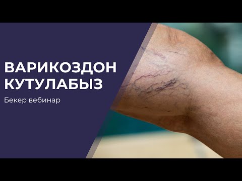 Видео: ВАРИКОЗДОН КУТУЛАБЫЗ | ДОКТОР ТУРАБЕКОВ