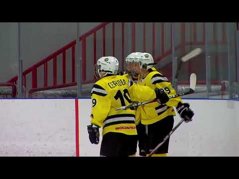 Видео: Обзор 2-го матча с ЖХК СКСО #жхл #shorts #аллхимики #жхкторнадо #вхл #жхксксо