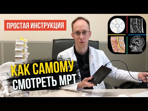 Видео: Как самому смотреть снимки МРТ с диска или флешки