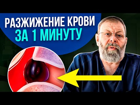 Видео: РАЗЖИЖАЮЩЕЕ ВСЕМИ ЗАБЫТОЕ БЛЮДО! Оно поможет навсегда забыть о тромбах и густой крови!