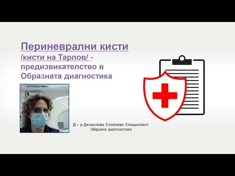 Видео: Д-р Д. Стойчева - Образна диагностика Кисти на Тарлов 07.03.2021 г