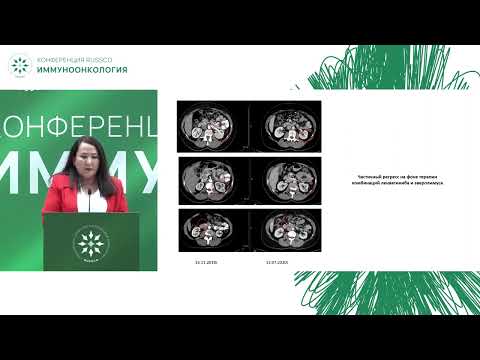 Видео: Иммуноонкология. Рак почки. Клинический случай