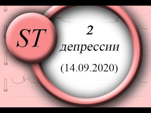 Видео: Дерпессия ST