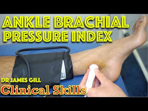 Видео: Как измерить ABPI (индекс лодыжечно-плечевого давления). Клиническое обследование. Сосудистая ОСК...