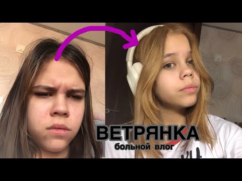 Видео: БОЛЬНОЙ ВЛОГ | заболела ветрянкой | медовая