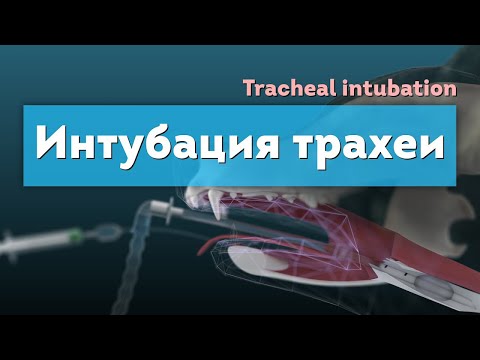 Видео: Интубация трахеи. Tracheal intubation 3D