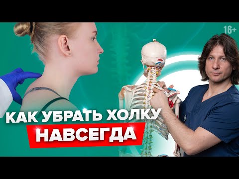 Видео: 3 супер-упражнения от ХОЛКИ НА ШЕЕ. Как убрать холку, или вдовий горбик.