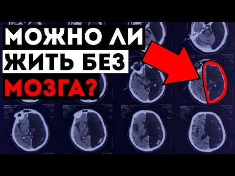 Видео: Можно ли жить без мозга?
