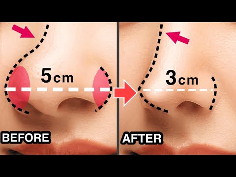 Видео: 8 минут Получите стройный, острый, красивый нос с помощью этого массажа! | Похудеть, изменить форму