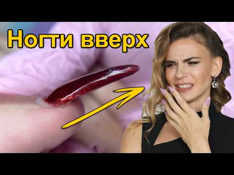 Видео: Широкие и Вверх Растущие Ногти - Как Исправить !? Наращивание RuNail