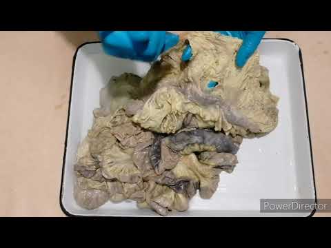 Видео: Брыжеечная часть тонкой кишки  Толстая кишка