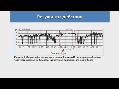 Видео: Мельников К.Н. Средства, влияющие на ЖКТ