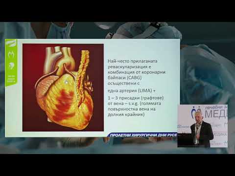 Видео: 67. Хирургична реваскуларизация - настояще и бъдеще, Surgical revascularisation - present and future
