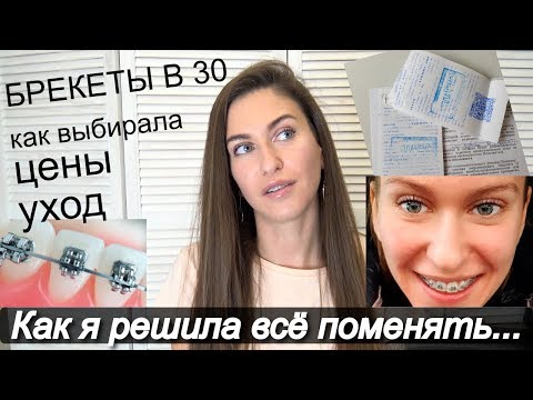 Видео: Поставила БРЕКЕТЫ в 30 лет 💎 Зачем / Сколько стоит поставить брекеты / Уход за брекетами МОТИВАЦИЯ