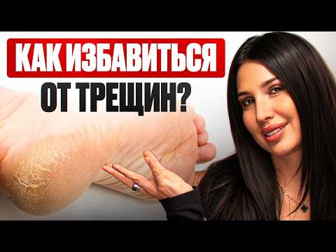 Видео: ТРЕЩИНЫ НА ПЯТКАХ. Как убрать НАВСЕГДА без кремов и аптек