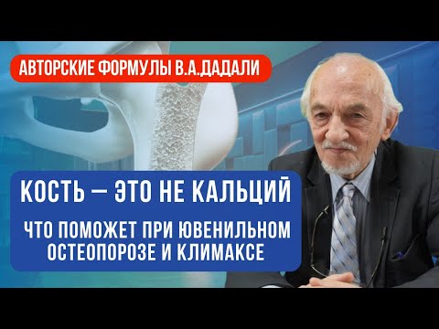 Видео: Эти напитки провоцируют ювенильный остеопороз. Профилактика остеопороза при климаксе.