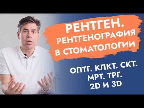 Видео: Рентген. Рентгенография в стоматологии. ОПТГ. КЛКТ. СКТ. МРТ. ТРГ. 2D и 3D.