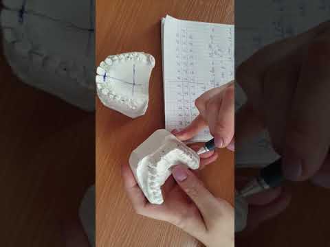 Видео: Метод Пона 3