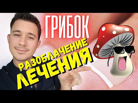 Видео: Грибок ногтя / Вросший ноготь / Микоз / Лечение
