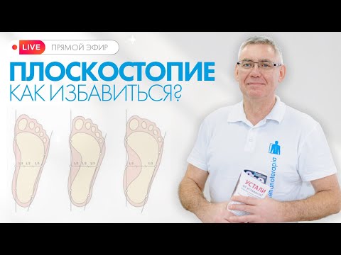 Видео: Плоскостопие у детей и взрослых: диагностика, лечение и упражнения