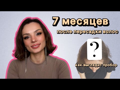 Видео: 7 месяцев после пересадки волос
