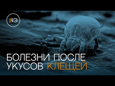 Видео: Диагноз: укусы клещей | Доктор, что это?
