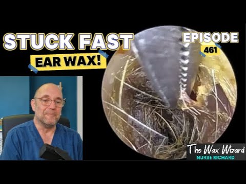 Видео: УШНАЯ СЕРА ЗАСТРЯЛА! Эпизод 461 (застряла, как липкая штука в липкой ситуации!)