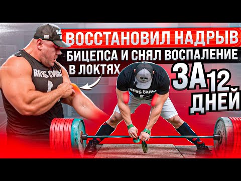 Видео: Восстановил надрыв бицепса и снял воспаление в локтях за 12 дней