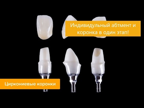 Видео: Коронка и абатмент в одном проекте. Моделировка зубов. Резец. Экзокад. Exocadю