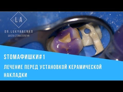 Видео: STOMAФИШКИ#1 Лечение перед установкой керамической накладки